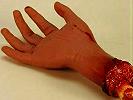 severed hand - file photo