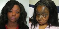 Mary Konye, left, and Naomi Oni, pictured after the acid attack in which she suffered serious burns to her face and chest and lost her hair and eyelashes. 