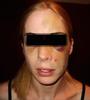 "Domestic Violence Victim - dramatization from Google Images